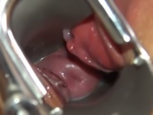 Camera deeply in her gaped vagina vagina