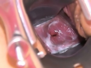 Gyno toys in her deep vagina hole