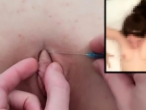 Kinky teen gets her shaved cunt sealed shut with needles